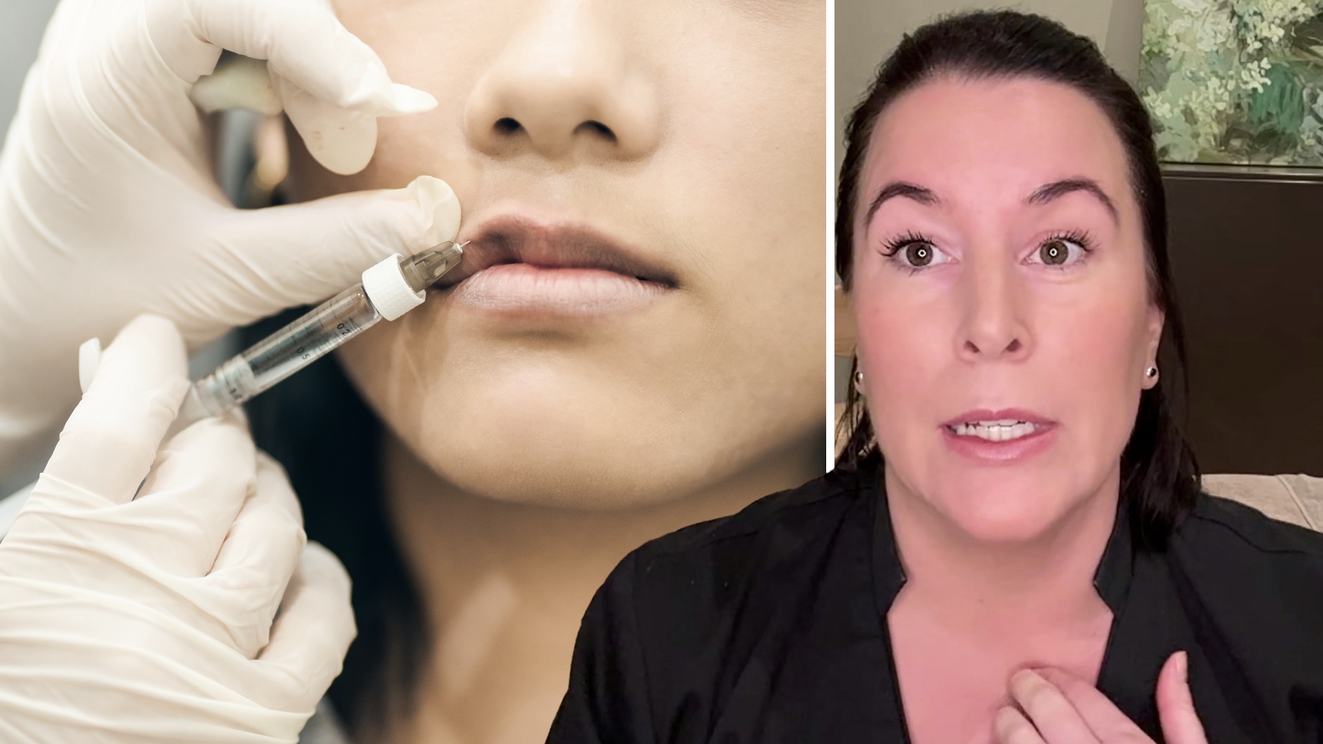 Falska friskvårdskvitton används till fillers och botox