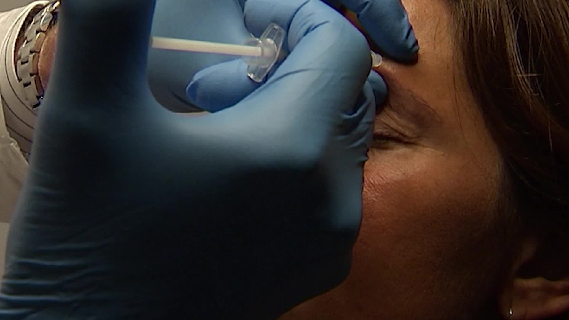 Varnar för ny skönhetstrend med injektioner – från döda